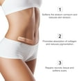 thumbnail image 4 of Aliver 60 inch Silicone Scar Roll, Adhesive Silicone Tape for Scar Tape, 4 of 8