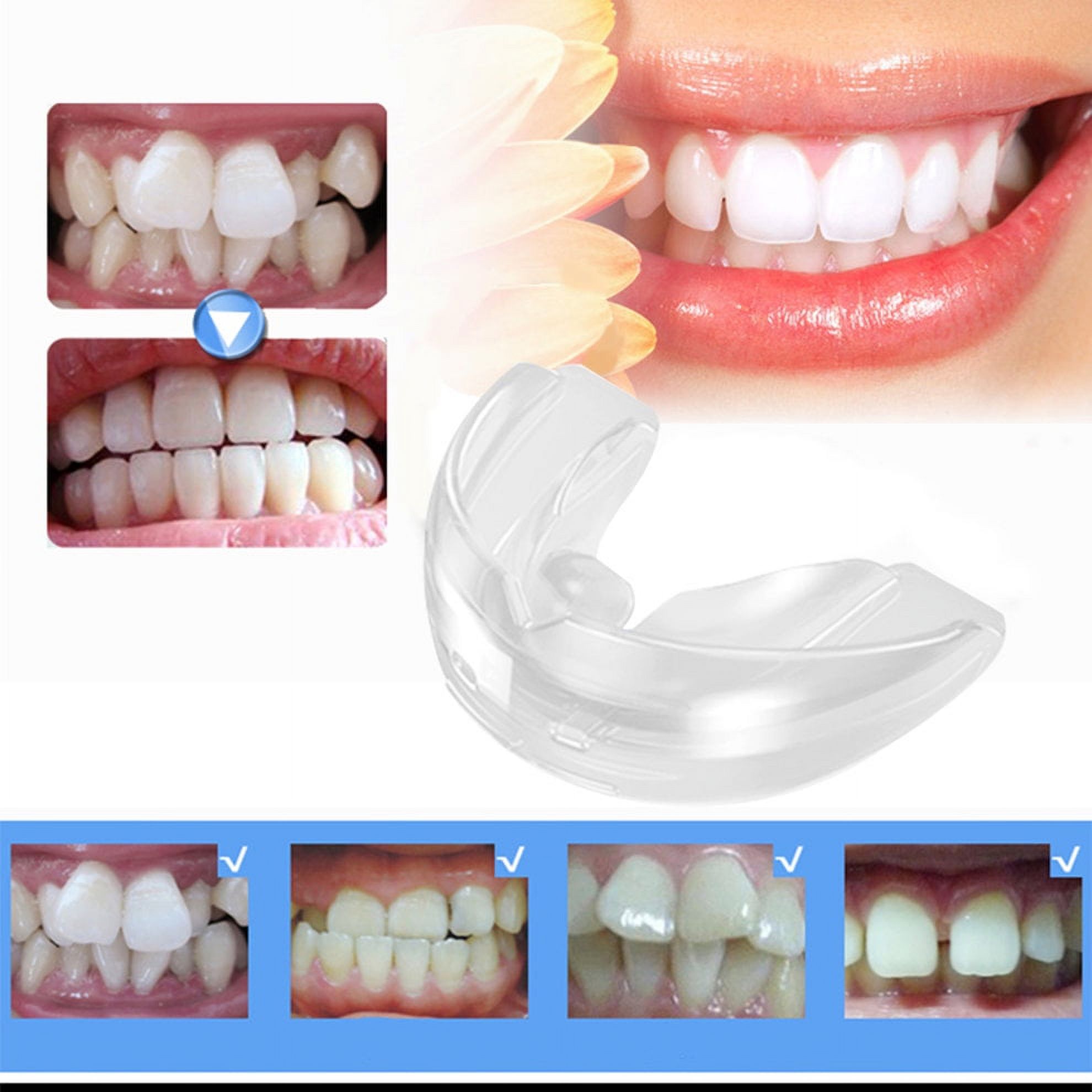 TINGYI High Quality Tooth Teeth Orthodontic Appliance