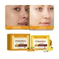 thumbnail image 4 of Gunyslmo Lemon Turmeric And Kojic Acides Brighetning Soap 100g, 4 of 7