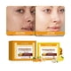 thumbnail image 5 of Fiudx Jabón de Limón y Cúrcuma, Barra Iluminadora de Ácido Kójico, Limpiador Facial Natural, Doble Efecto Blanqueador, Suave para El Afeitado Facial y Corporal, Apto para Todo Tipo de Piel, Fórmula E, 5 of 6