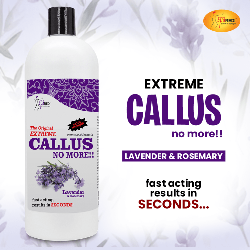 SPA REDI Callus Remover - Removes Toughest Calluses in Seconds and Smooths Dry Cracked Heels, Softens and Smooths Feet, Lavender & Rosemary - 32 Oz
