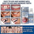 thumbnail image 4 of False Teeth Solid Glue Temporary Tooth Repair Kit Moldable Thermal Fitting Teeth Pellet Adhesiv, 4 of 5