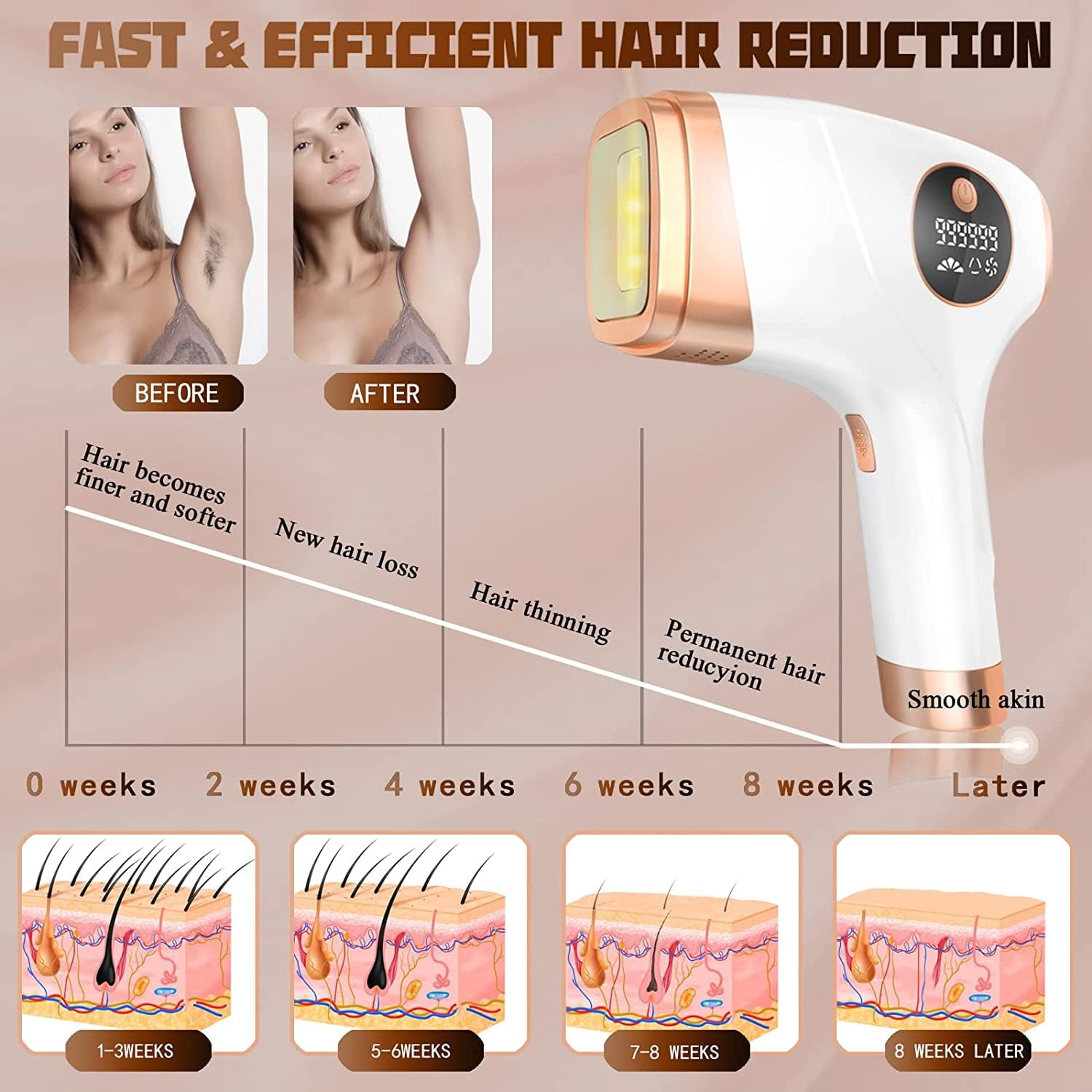 (3 pack) Yoovee IPL Laser Hair Removal Device – Ideal for Bikini Areas & Beyond,  Enhanced with 999,999 Flashes, FDA Approved