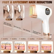 Yoovee IPL Laser Hair Removal Device – Ideal for Bikini Areas & Beyond, Enhanced with 999,999 Flashes, FDA Approved