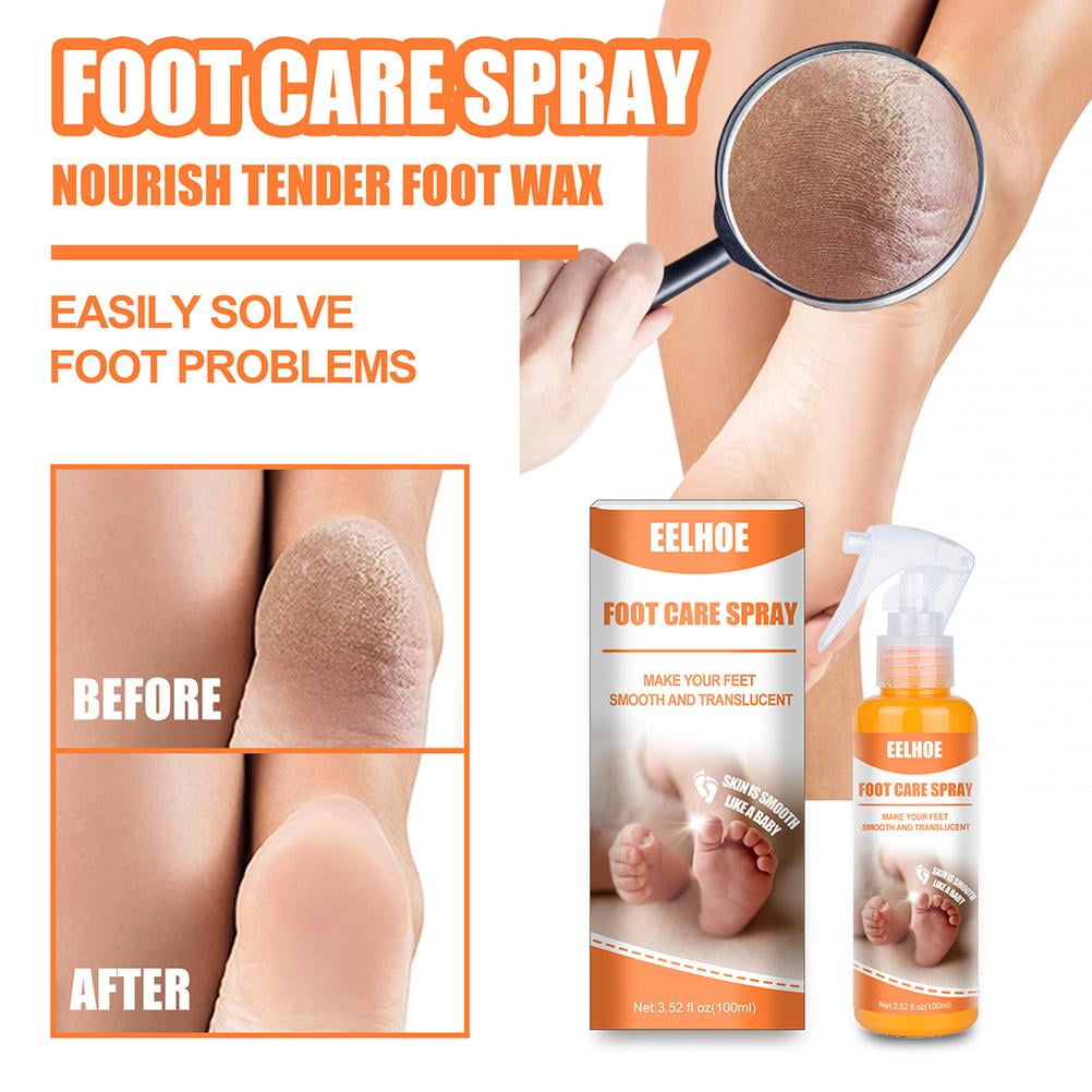 Hand And Foot Peeling Spray 60Ml Callus Dead Skin Removal Spray Foot Heel  Cracked Repair Exfoliating & Moisturizing for Dryness Hand Feet Care 60Ml