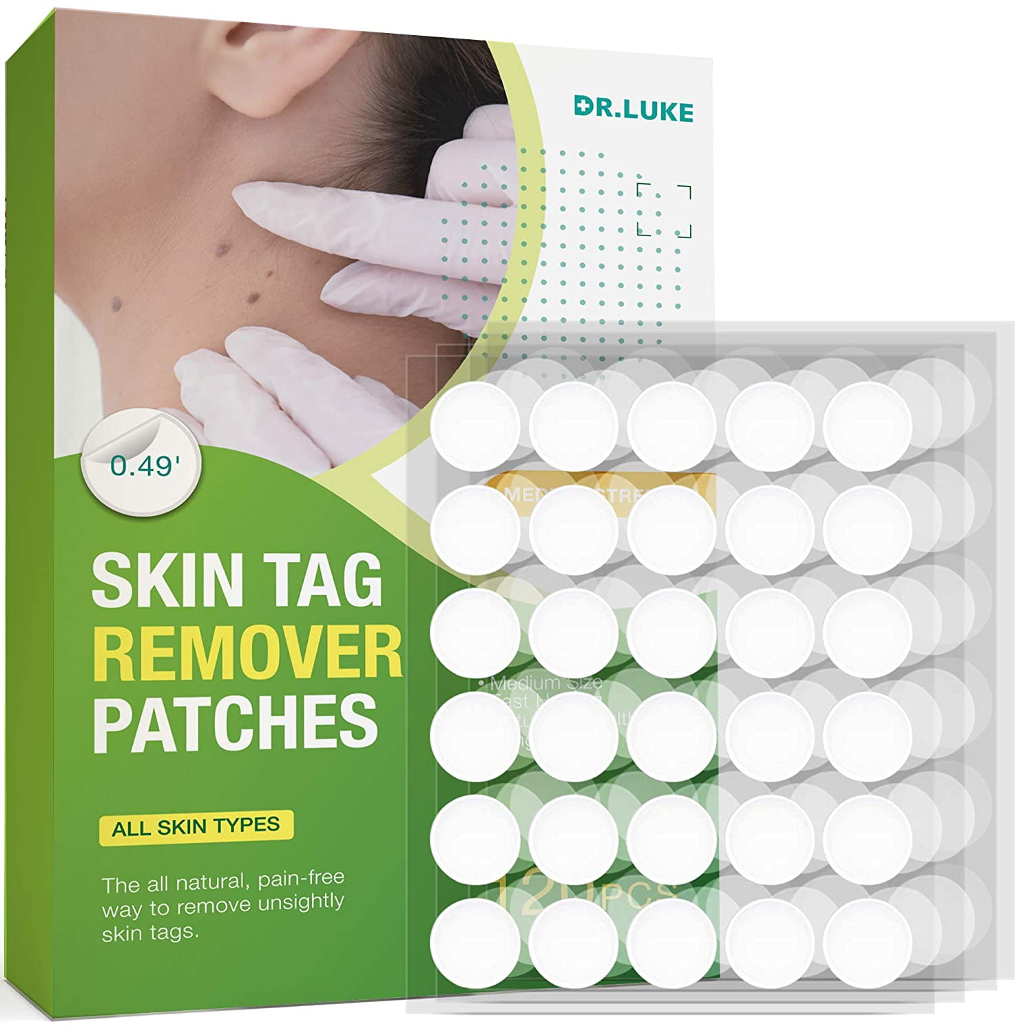 Skin tag removal aptgerty