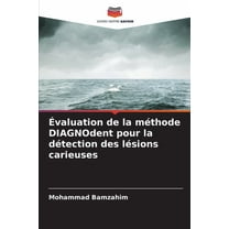 Ãvaluation de la mÃ©thode DIAGNOdent pour la dÃ©tection des lÃ©sions carieuses, (Paperback)