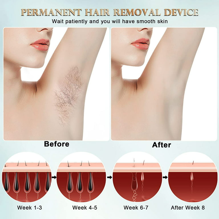 Braun Silk Expert Pro 3 PL3012 Latest Generation IPL for Women, Permanent  Hair Removal