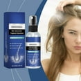 5Topical Solution Hair Growth Spray For Men And Women Hair Regrowth