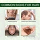 thumbnail image 5 of Compre 2 y obtenga 3 Aceite esencial de romero de 60 ml, utilizado para el crecimiento del cabello, cejas y pestañas, cuidado de la piel, aceite de tratamiento contra la caída del cabello para hombre, 5 of 8