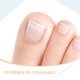 thumbnail image 4 of 5 tiras correctoras transpirables para el tratamiento de uñas encarnadas, cuidado de las uñas, tira para el dedo gordo, enderezador de uñas transparente para la corrección de uñas de los pies, 4 of 8