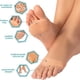 thumbnail image 4 of Almohadillas metatarsianas de silicona, separador de dedos para aliviar el dolor, almohadillas ortopédicas para masaje de pies, calcetines en la parte delantera, herramienta para el cuidado de los pie, 4 of 4