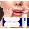 thumbnail image 2 of Virulite 2.0 Enhanced Penetration Infrared Light Therapy Device for Cold Sores - Handheld Light Therapy Wand, Safe Lip, Mouth and Cold Sore Treatment - Portable Infrared Wand Device, 2 of 7