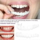 thumbnail image 3 of Fundas dentales postizas Smile Dental Perfect Smile Carillas Comfort Fit Flex Dentadura postiza, 3 of 5