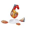 thumbnail image 5 of Isaac Technologies IC-B10438 Modèle de Cœur Humain - 4 Parties 2x Taille Réelle Montre les Détails de l'Anatomie Externe et Interne avec Ventricules, Oreillettes, Valves, Veines et Aorte Diagramme Étiqueté Inclus, 5 of 5