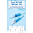 thumbnail image 5 of 1-5PCS 4ml Nail Antifungal Gel Anti-Infection Infected Nail Infection Nail Ringworm Nail, 5 of 5