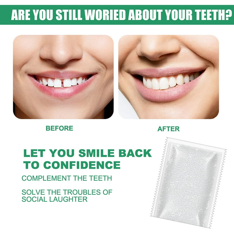 Temporary Tooth Repair Kit Teeth And Gaps False Teeth Solid Glue Denture  Teeth