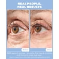 thumbnail image 2 of Crema para ojos Then I Met You Snail Mucin 15 ml, 2 of 8