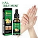 thumbnail image 2 of 7 Days Nail Fungus Treatment, Jaysuing 7 Days Nail Fungus Treatment, Ginger Nail Fungus Treatment_c*, 2 of 5