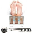 thumbnail image 5 of Pedicure Callus Shaver Foot File Care Hard Skin Remover Callus Shaver Sets with Case, Foot File Heads & 10 Replacement Blade for Hand Feet (Wood Handle), 5 of 5