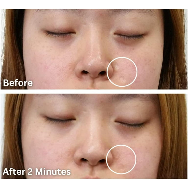 Scar Filler Makeup For Face edu.svet.gob.gt