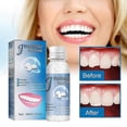 thumbnail image 3 of dental caps repair kit for lost fillings and teeth, 3 of 5