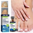 thumbnail image 2 of Nail Fungus Treatment, 30ml Nail Repair Liquid for Toenail and Fingernail, Restore Healthy Nails, 2 of 5