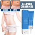 thumbnail image 2 of Almohadillas de cúrcuma Belleza y eliminación de cicatrices Mantiene la piel del rostro y el cuerpo hidratada y repara la piel dañada Gel para cicatrices Gel para cicatrices 15 g, 2 of 9