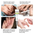 thumbnail image 3 of Nail Repair Gel Quickly Improves The Appearance Of Infected/cracked Nails, 3 of 4