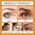 thumbnail image 4 of Bee Honey Eye Care Drops, Discomfort Treatment Relieve Eye Fatigue, Dryness, Itching & Red Eyes, Improve Blurred Vision & Prevent Infections, 4 of 5