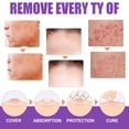 thumbnail image 4 of Líquido para eliminar verrugas, líquido para eliminar la piel del cuello, excrecencia de la piel Facial, líquido acuminado axilar, 30ML, 1,01 FLOZ, 4 of 4