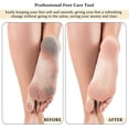 thumbnail image 4 of 4 In 1 Foot Pu Brush Combines Foot File Callus Remover With Pu File Scrub Foot Care Tool For Women Men Foot Salon Or Home Use2pcs-, 4 of 5