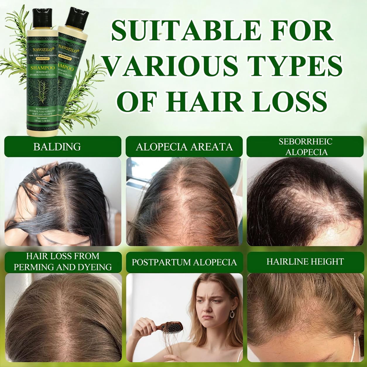 NAVOZILO Rosemary Keratin Scalp Shampoo, Professional Hair Shampoo with Hydrolyzed Keratin, Scalp Care Formula for Thicker-Looking, Stronger-Feeling Hair, for Women & Men  (1PCS)