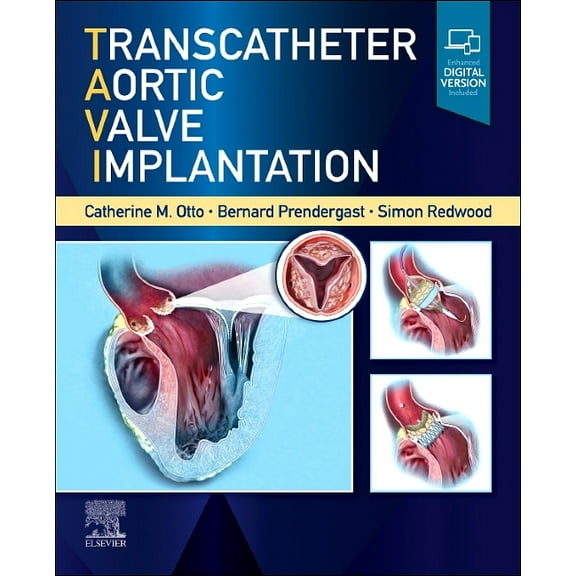 Transcatheter Aortic Valve Implantation, (Hardcover)