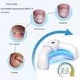thumbnail image 4 of Welnax BioClear Nail Fungus Lamp, 4 of 5