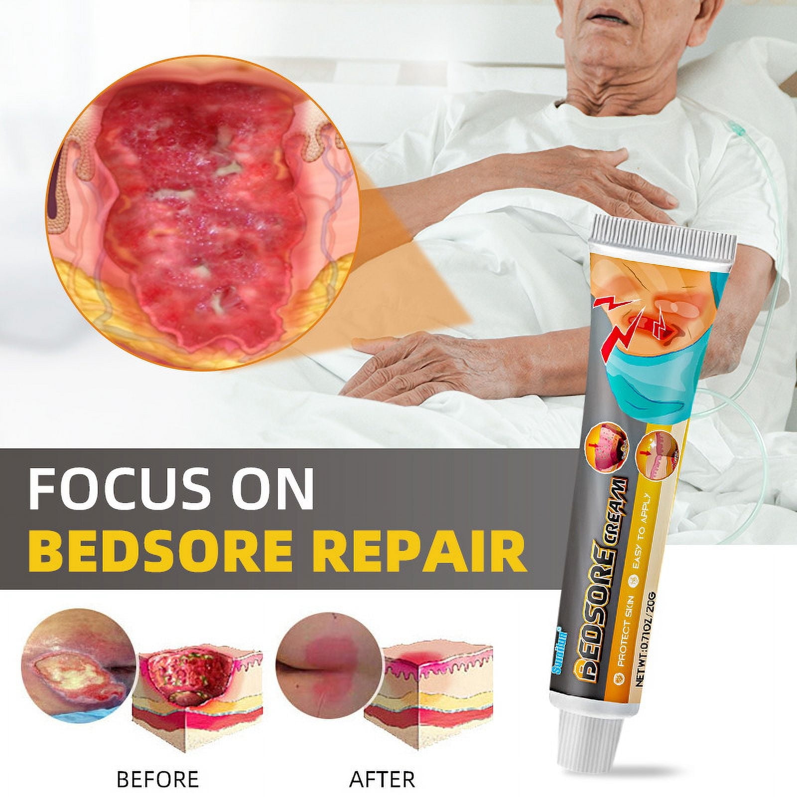 Bedsore Cream Moisturize Decubitus,Ulcer Cream,Rapid absorption,quick-acting,Remove Rots Myogenic Pressure Ulcer Cream Wound Healing Body Care.Wound Healing Cream for Skin Care,3pcs