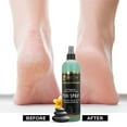 thumbnail image 5 of FOOTSPA - Pedi Spray Antiseptic, Mint & Eucalyptus - Refreshing Foot Care - 16 Ounces, 5 of 7