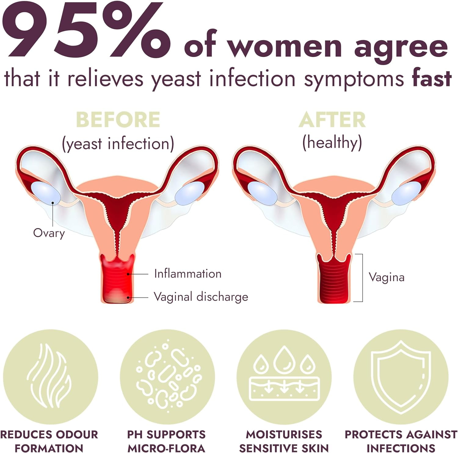 Yeast Infection Treatment for Women | Antifungal Ointment Helps Relieve Itching & Irritation | Vaginal Aid for Inflammation, Dryness & Watery Discharge | Feminine Care | 7 Pre-Filled Applicators
