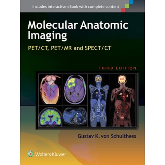 Pre-Owned Molecular Anatomic Imaging: PET/CT, PET/MR and SPECT CT (Hardcover) by Gustav K. von Schulthess