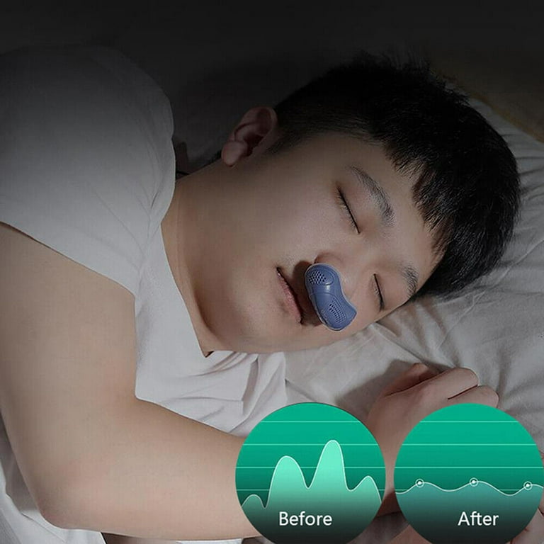 MiCPAP Micro CPAP Anti Snoring Device for Sleep Apnea Stop Snore Aid  Stopper TOP