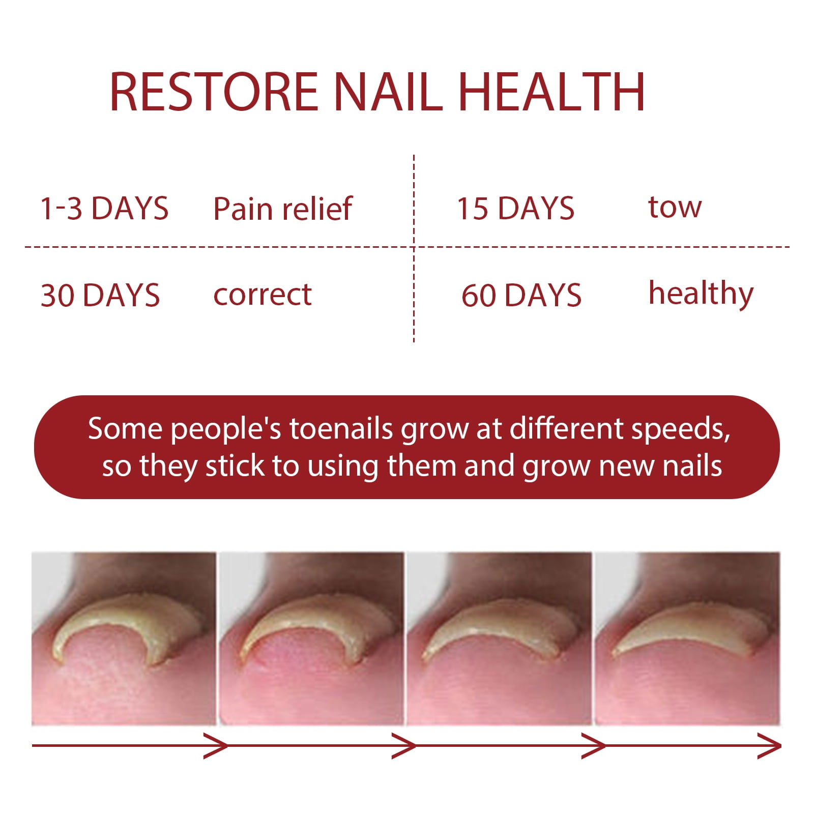 Alvantor Ingrown Toenail Treatment, Pain Relief and Nail Care for Ingrown Corrector and Fungus Treatment, 0.34fl.oz