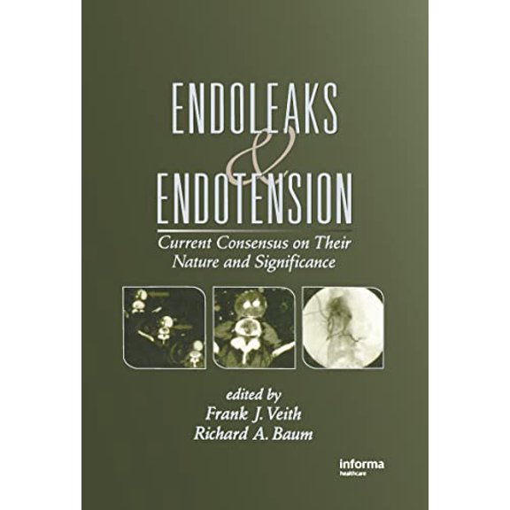 Pre-Owned Endoleaks and Endotension: Current Consensus on Their Nature and Significance, 9780824709549, 0824709543, Hardcover, 1 edition