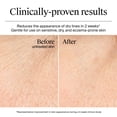 thumbnail image 3 of Crema Gel Hidratante Facial Neutrogena Hydro Boost 15 mL, 3 of 9