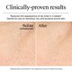 thumbnail image 3 of Crema Gel Hidratante Facial Neutrogena Hydro Boost 15 mL, 3 of 9