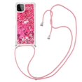 thumbnail image 1 of Funda FOXDOCK para Samsung Galaxy A22 5G con Cuerda Ajustable, Brillo Líquido, Protección Antigolpes y Lente – Ideal para Regalo, 1 of 6