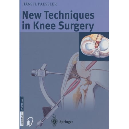 New Techniques in Knee Surgery (Paperback)