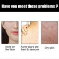 thumbnail image 4 of Jaysuing Shea Butter Black Soap Face Body Cleansing Soap Moisturizing Oil Control Soap 100G |, 4 of 5