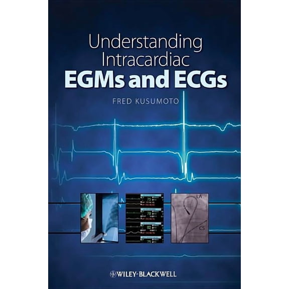Understanding Intracardiac EGMs and ECGs (Paperback)