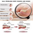 thumbnail image 2 of Nail Fungus Treatment -7 Day Nail Fungus Treatment, Nail Fungus Treatment For Toenail And Fingernail, Painless Fix And Renew Damaged,Helps Nails Healt, 2 of 5