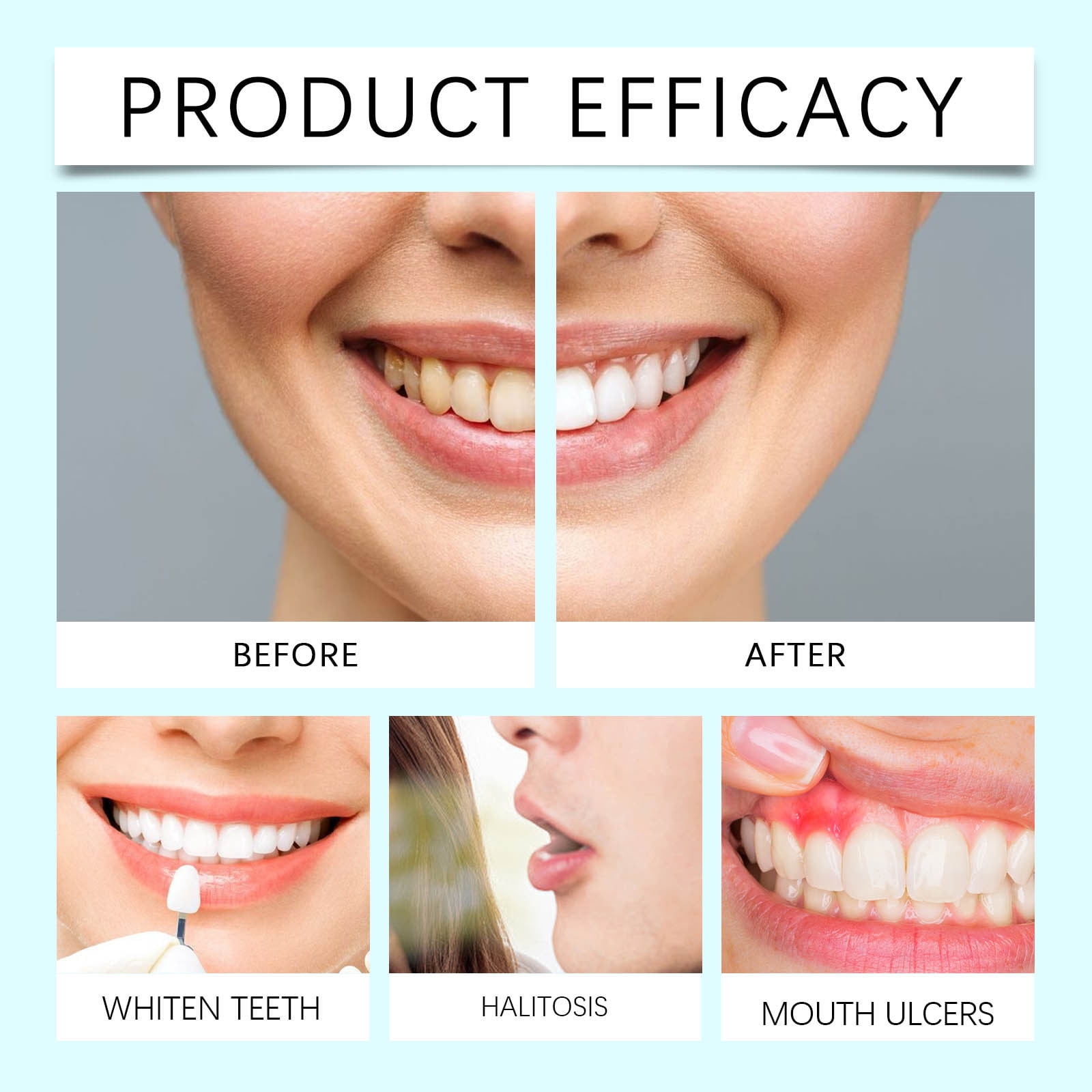 5 Bottles Nicotinamide Dazzle White Tooth Powder Bright White 100G/3.53OZ